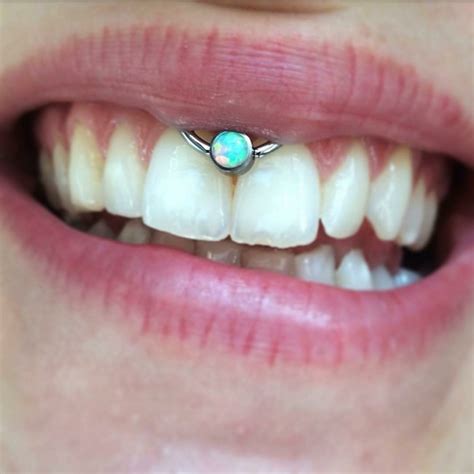 The Smiley Piercing: Pain Level, Aftercare, and Jewelry